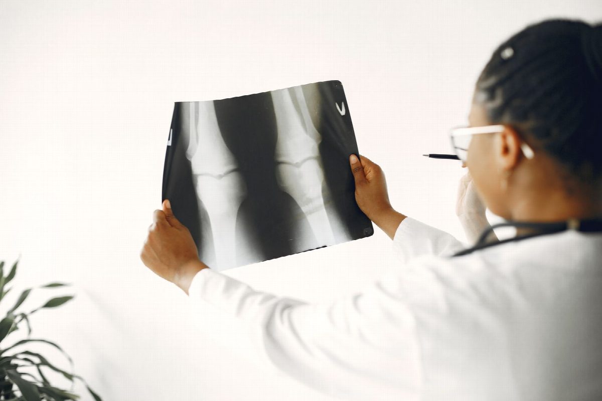 An orthopedic surgeon reviewing a patient's joint X-ray