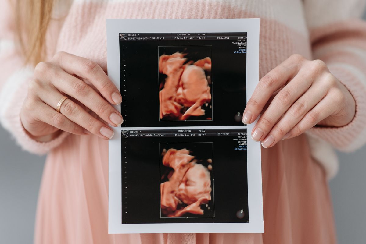 A prenatal ultrasound appointment